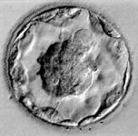 one-blastocyst-embryo-trans.jpg