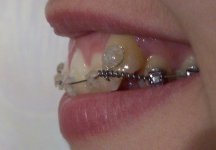 100_7436_1.jpg