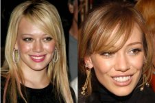 hilary-duff-teeth-before-and-after.jpg