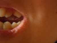 зубы.JPG