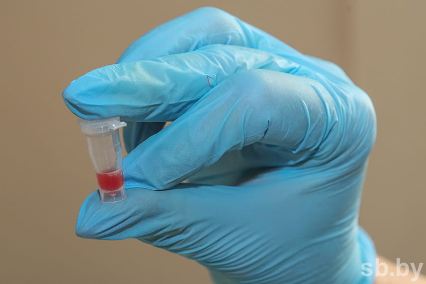 Новый сверхточный экспресс-тест на коронавирус дает результат за 10 минут 3