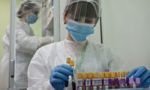 Учёные выяснили, что коронавирус заставляет антитела воевать с собственным организмом 13