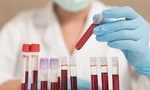 Ученые определили группы крови с самым сильным иммунитетом у их обладателей 15