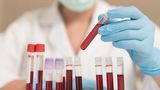 Ученые определили группы крови с самым сильным иммунитетом у их обладателей 1