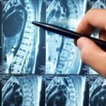 Магнитно-резонансная томография: Взгляд в Глубины Мозга и Спины 15