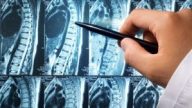 Магнитно-резонансная томография: Взгляд в Глубины Мозга и Спины 4