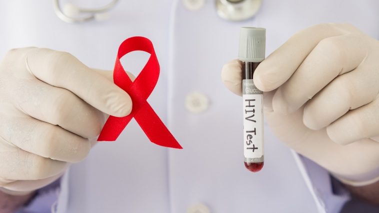 Где и как сдать тест на ВИЧ. Плюсы и минусы методов тестирования 1