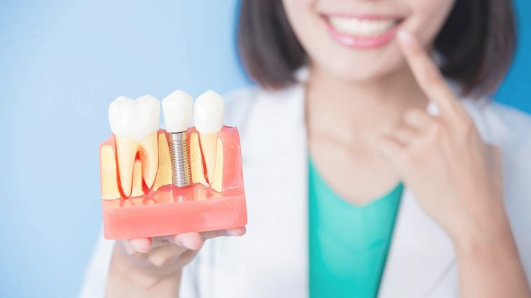 Имплантация зубов, мост или съемный протез? Разбираемся со стоматологом 1