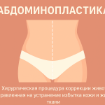 Абдоминопластика живота: сущность процедуры, показания, этапы и современные подходы 10