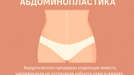 Абдоминопластика живота: сущность процедуры, показания, этапы и современные подходы 1