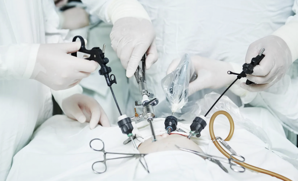 Абдоминальный хирург и онколог: специфика работы и операции по удалению желудка 1 Абдоминальный хирург