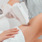 Лазерная эпиляция: принципы работы, виды оборудования и реальная эффективность 14 Лазерная эпиляция: принципы работы, виды оборудования и реальная эффективность 13