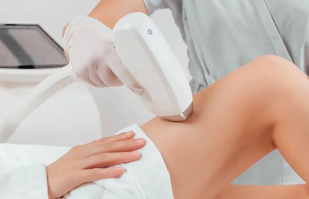 Лазерная эпиляция: принципы работы, виды оборудования и реальная эффективность 1
